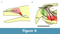 sfigure4