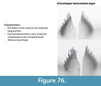 s figure76