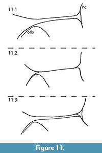 s figure11