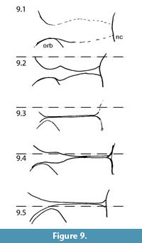 s figure9