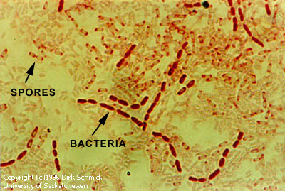 Subsurface bacteria
