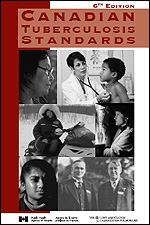 Canadian Tuberculosis Standards 2007