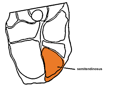 Image - ROUND - Cross-Section (semitendinous)
