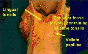 This is a photograph of an adult bovine tongue with palatine and lingual tonsils and vallate papillae. The tonsillar fossa (crypts) is identified: it contains the palatine tonsils.