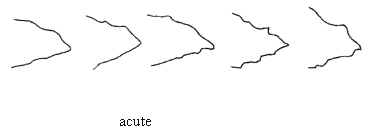 Leaf: shape of lobes - acute