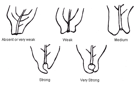 Image - Leaf Auricles - Top Left to right: Absent or very weak, Weak, Medium - Bottom Left to right: Strong, Very strong