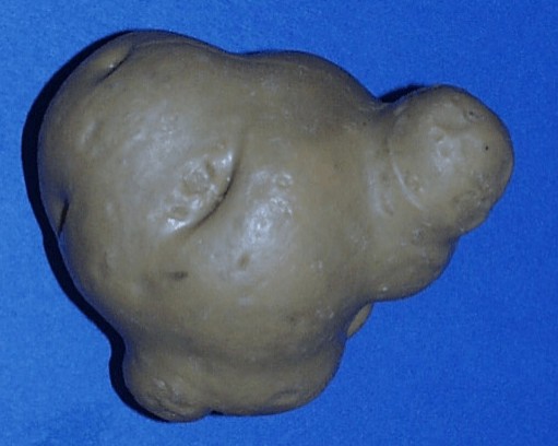 Tubercules avec excroissances