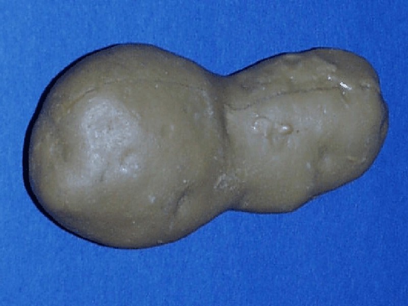 Tubercules en forme d'haltère